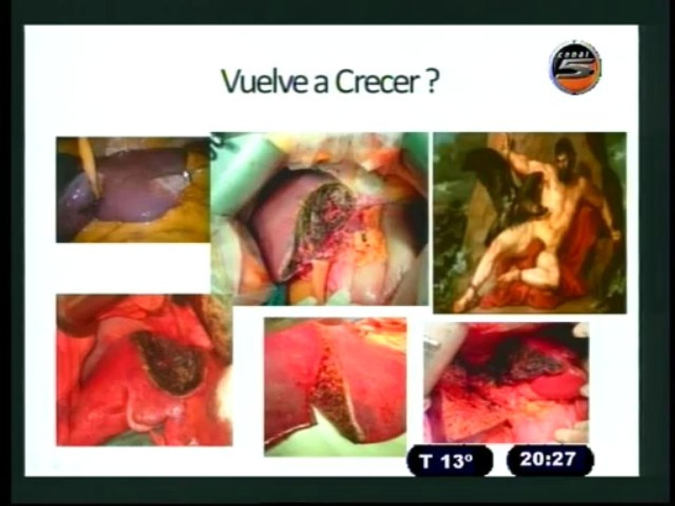 MICRO DE LA SALUD - 11-07-13