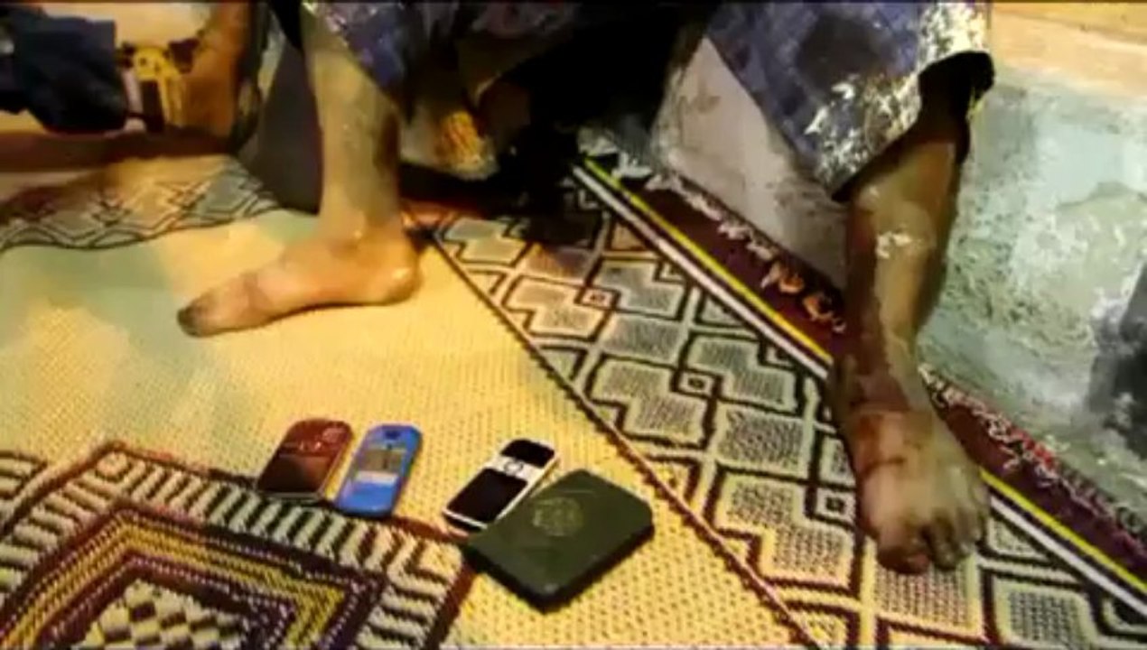 مصاب سيناوي يؤكد أن أتوبيس عمال مصنع الاسمنت قُصف بطائرة ولي