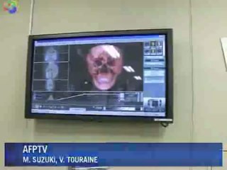 Dental Robot Hanako - JapanRetailNews