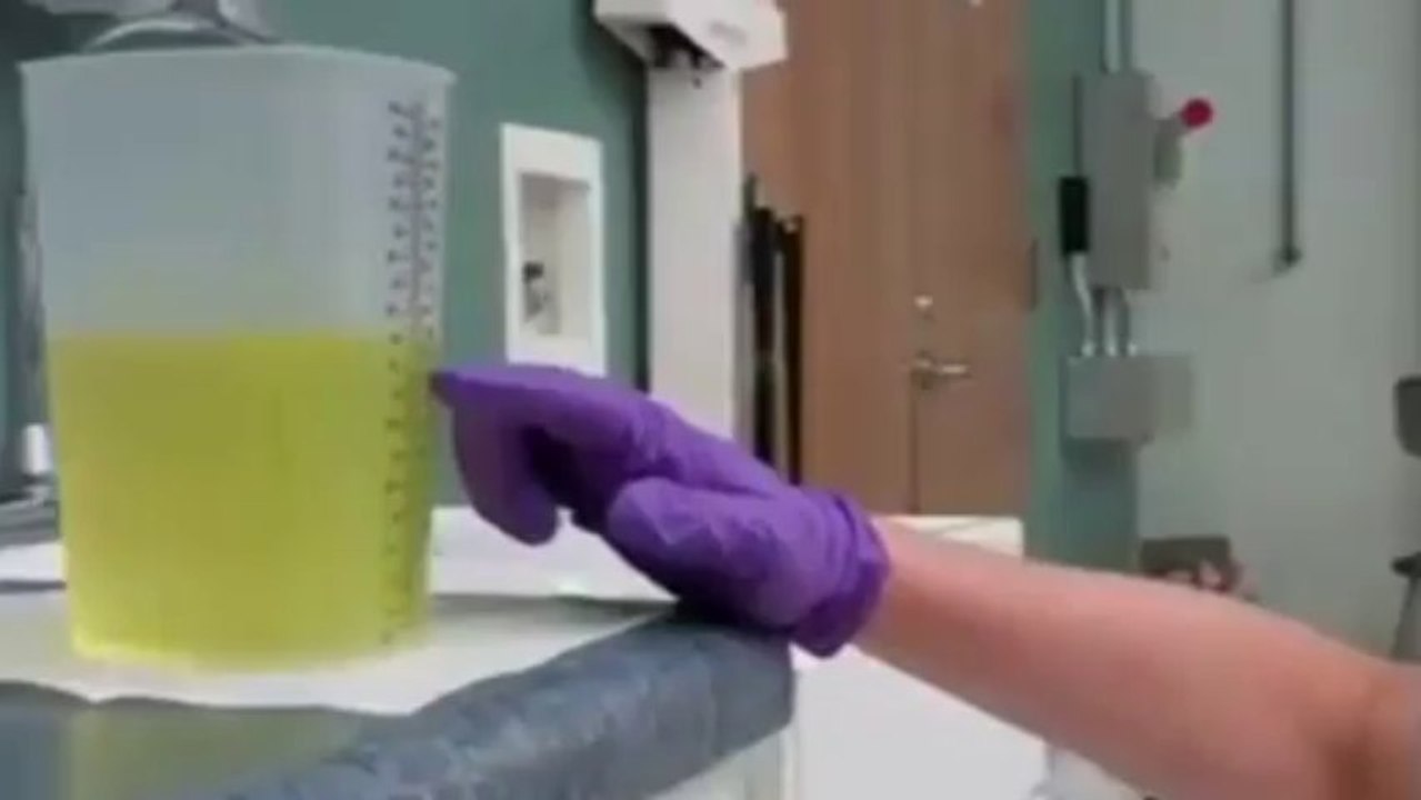 CNA Training Measuring urinary output