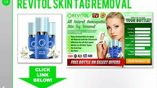 Best Way to Remove Warts: Revitol Skin Tag