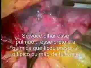 Paixão por Cigarros - Documentário BBC -