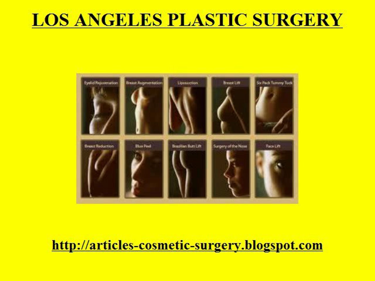 Los Angeles Cosmetic Surgery- Los Angeles Plastic Surgery