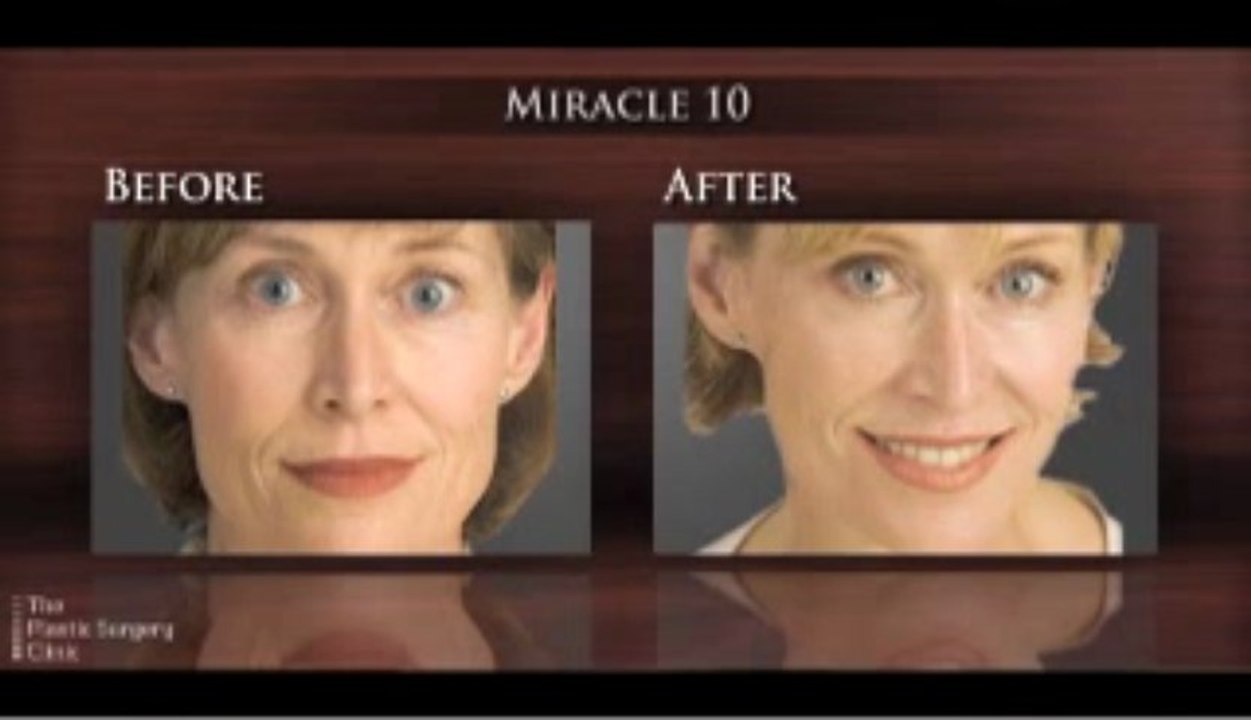 Facial Rejuvenation - The Plastic Surgery Clinic