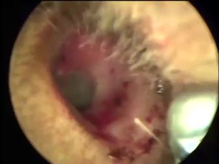 Cafard dans l'oreille