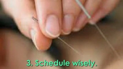 8 Points to keep in mind prior to an Acupuncture Campbell Visit