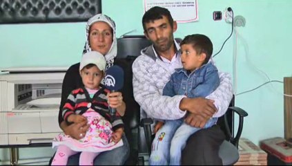 Gözleri görenleri şaşırtıyor