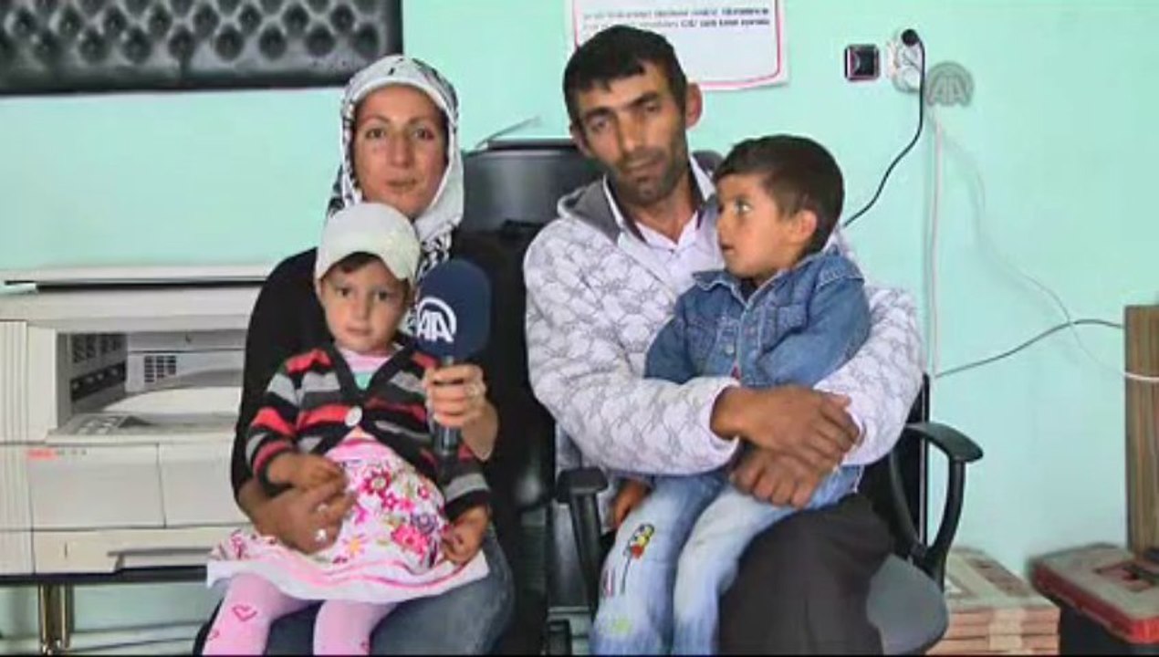 Gözleri görenleri şaşırtıyor