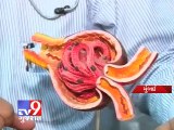 Tv9 Gujarat - Mumbai : Blind man donates Kidney to his Brother