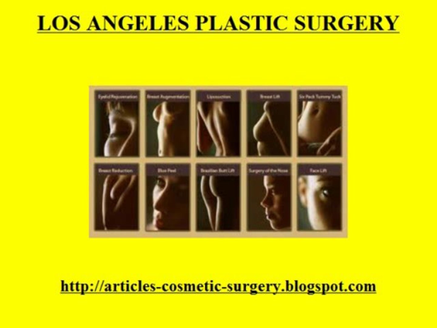Los Angeles Plastic Surgery- Cosmetic Surgery Los Angeles