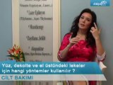 Yüz dekolte ve el üstündeki lekeler için hangi yöntemler kullanılır  ?