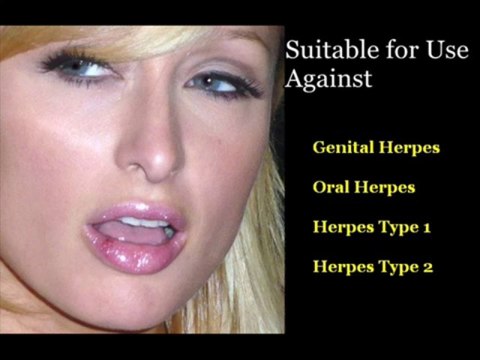 Herpes Simplex 2 - How to Get rid of Herpes Simplex 2 Virus forever!