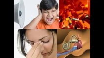 Remedios Caseros Para El Tinnitus - Milagro para el Acufeno - Tratamiento para el zumbido de oidos