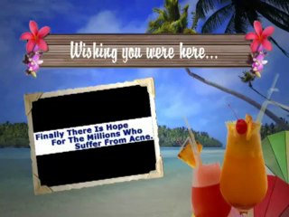 Acne No More By Mike Walden Download