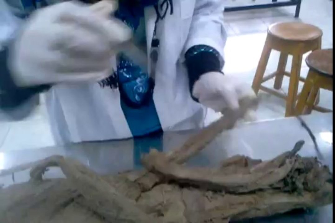 Human Anatomy - Gluteal region