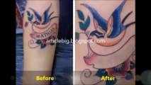 Tattoo Removal Cream - Get Rid Tattoo [Discounted Price]