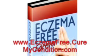 A Patient's Honest Review of Rachel Anderson's Eczema Free Forever Treatment Program - Pros and Cons