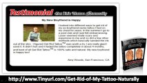 Get Rid Tattoo Naturally Tattoo Removal Solution | Get Rid Tattoo Fast