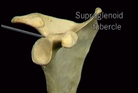 Clip Aclands DVD Atlas Human Anatomy 1of6 Upper Extremity Divx6 mp3 wogre00165221 58 26