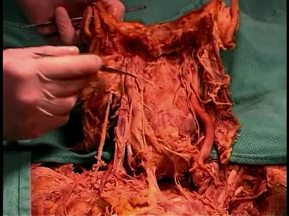 Human Anatomy Dissection 18 (part 2 of 3) Pharynx