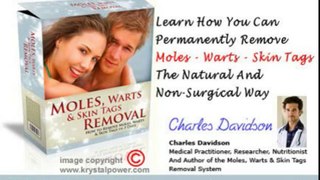 Moles, Warts & Skin Tags Removal Review + Bonus