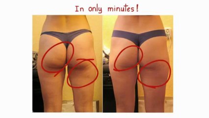 Cellulite Factor-Lose Unwanted Cellulite