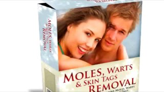 3 Day Natural Warts, Moles, Skin Tags Removal