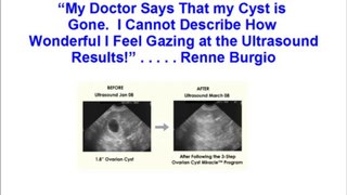 Ovarian Cyst Miracle Reviews - Check out Ovarian Cyst Miracle Reviews Here