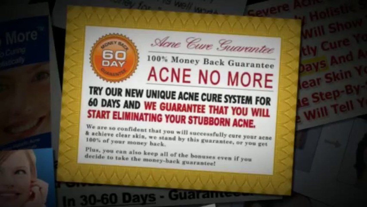 Acne No More Book Review