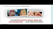 Moles Warts _ Skin Tags Removal - Removing Skin Tags At Home Guide - Review