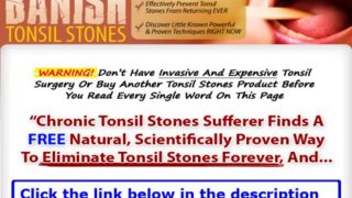Banish Tonsil Stones Pdf Download Free + Banish Tonsil Stones Ebook