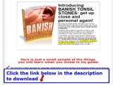 Banish Tonsil Stones Pdf   Banish Tonsil Stones Diane Puttman