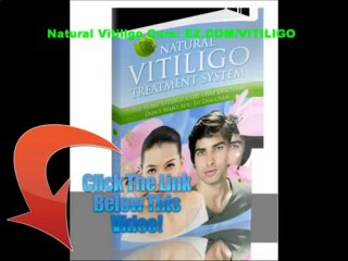 NATURAL VITILIGO TREATMENT SYSTEM DISCOUNT 10$