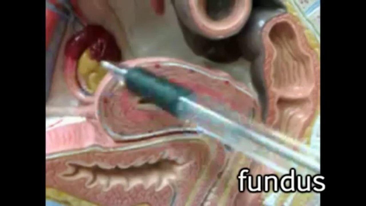 Human Anatomy 361 - Female Reproductive System