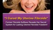 Treatment of Uterine Fibroids...Fibroids Miracle Review Natural Treatment Effective In Hours.