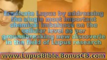 The Lupus Bible Norton Protocol 5 Controlled and Precise Steps to Eradicate Lupus by Julia Lui