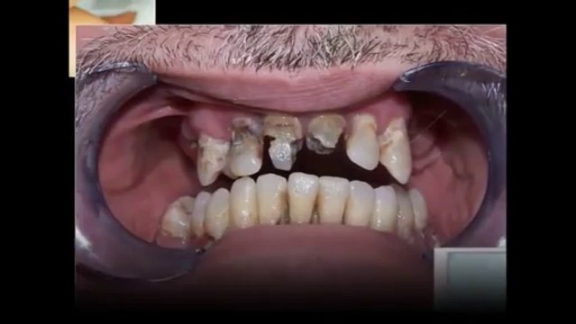 Orthodontist Office Saskatoon - Call (877) 732-9136