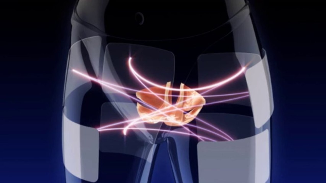 Kinésithérapeute : découvrez le Neurotech Vital pour lutter contre l'incontinence