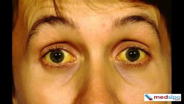 ALT (SGPT) Test - Liver Diseases Testing