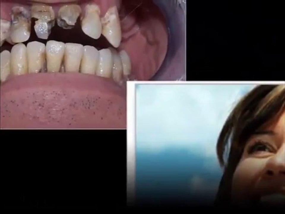 Private Orthodontist Toronto - Call Now (877) 399-9477