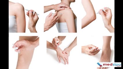 Synovial Fluid Analysis (Results Interpretation, Sample, Risks)