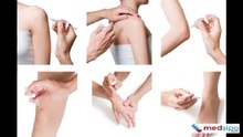 Synovial Fluid Analysis (Results Interpretation, Sample, Risks)