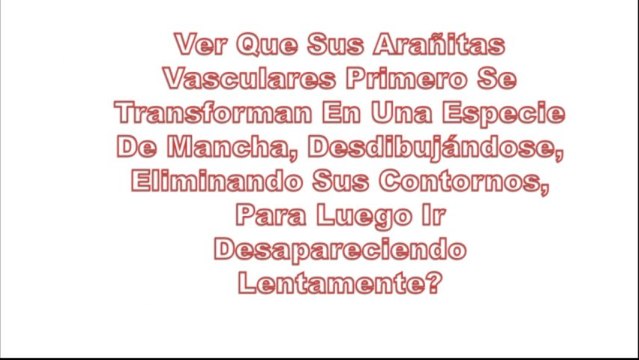 Como Se Quitan Las Varices