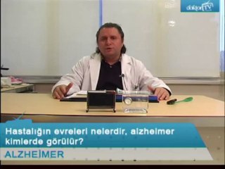 Alzheimer hastalığınının evreleri nelerdir kimlerde görülür ?