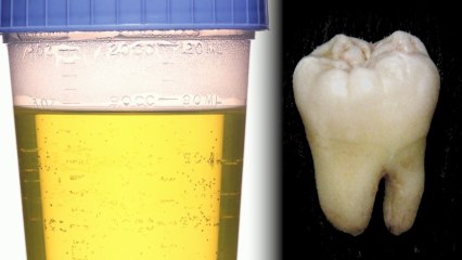 Science Makes Squishy Teeth from Human Urine