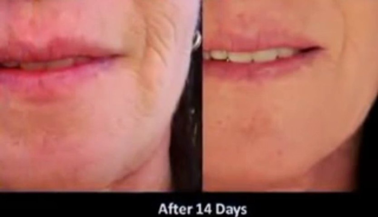 Face Moisturizer and Lotion