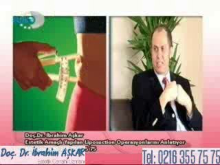 Liposuction göbek bölgesine nasıl uygulanır