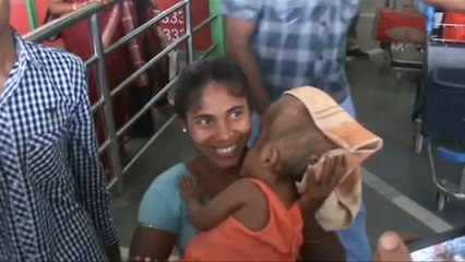 Dan alta a niña con hidrocefalia