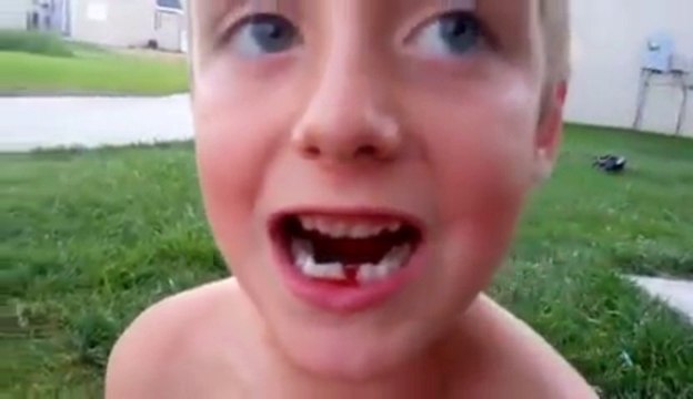 Dentiste de l'espace - se faire arracher une dent avec une fusée!