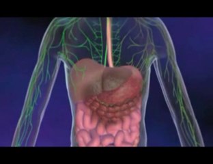 L'adénocarcinome gastrique , le cancer de l'estomac ,Stomach cancer
